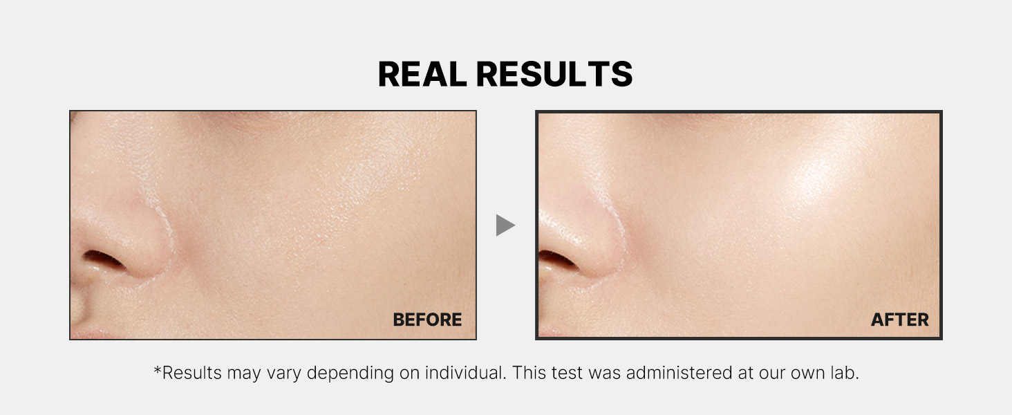 KEY BENEFITS OF BOOSTER H, KOREAN SKIN CARE DEVICE THAT MAXIMIZES SKIN CARE